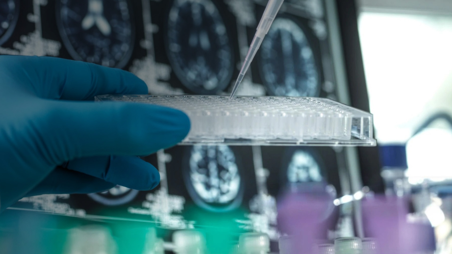UC Irvine medical research